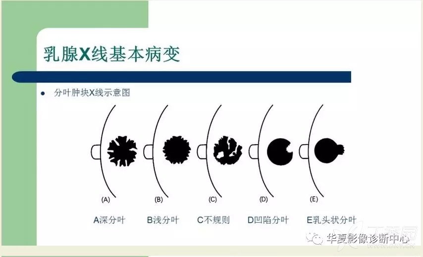 3分钟教你科普“心悦填大坑有什么规律”(详细透视教程)-知乎