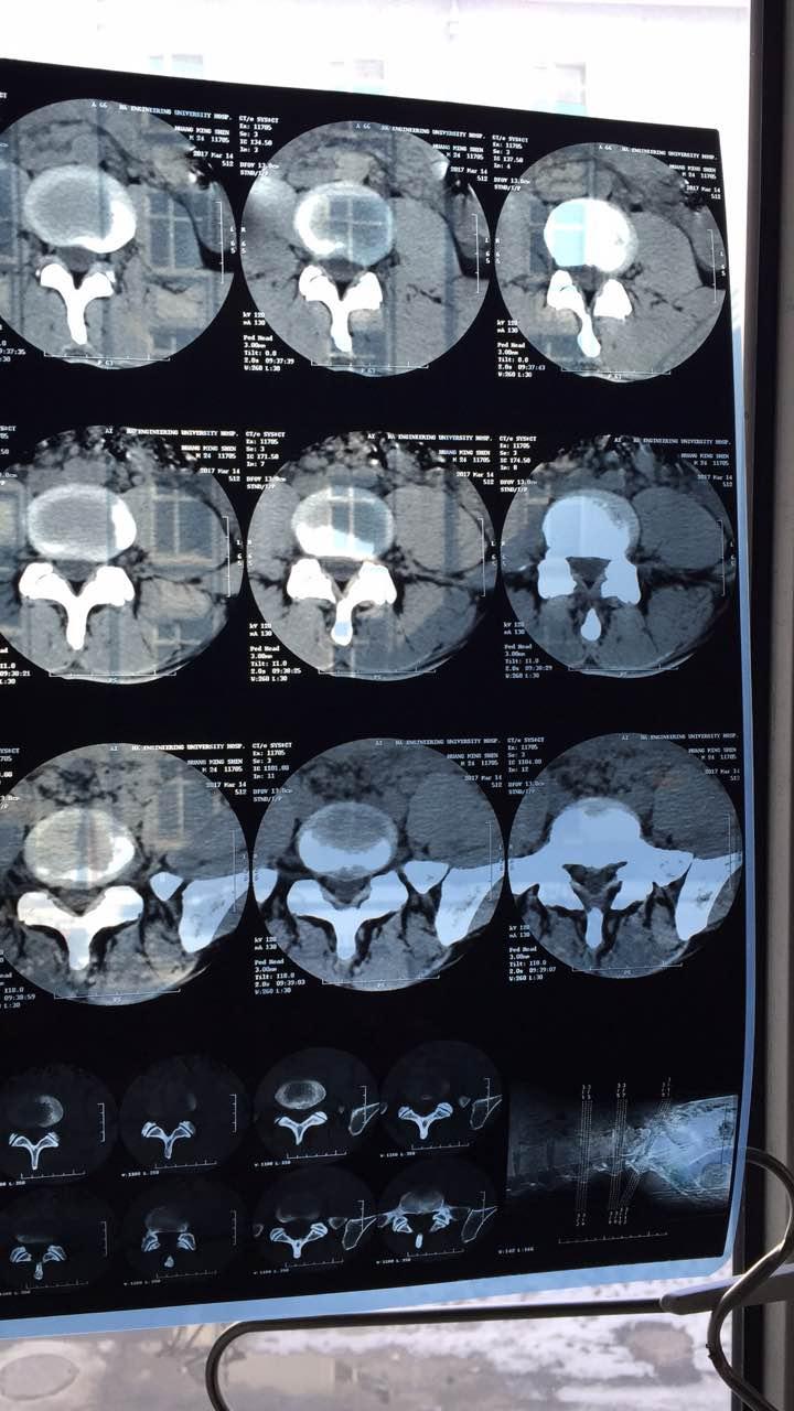 我来教教大家“CT穿透器可以提前知道普通瓷碗是真的吗《新浪科技 讲解窍门》